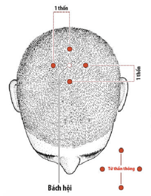 huyệt bách hội