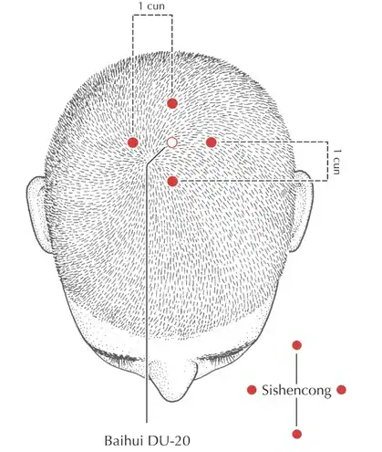 Sishencong_acupoints