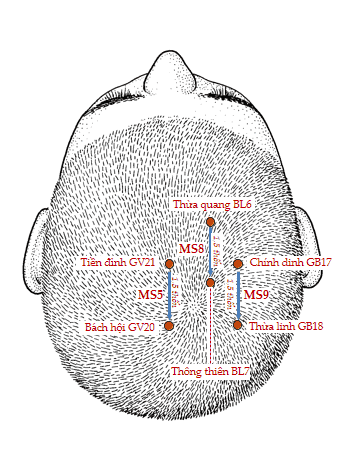 huyệt thừa quang